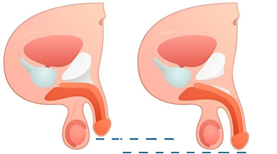 Көпшілікпен секс хатшысы